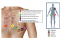 วิธีการตรวจคลื่นไฟฟ้าหัวใจ(Electrocardiography: EKG)