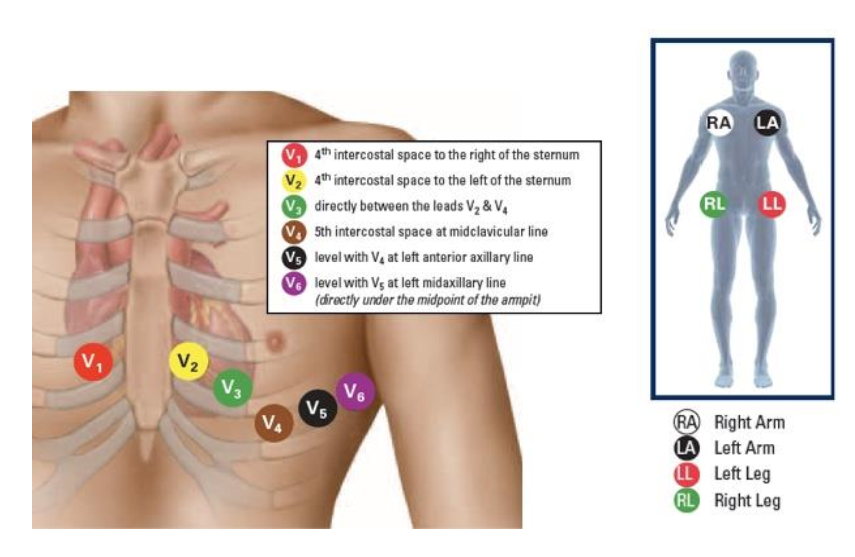 ekg