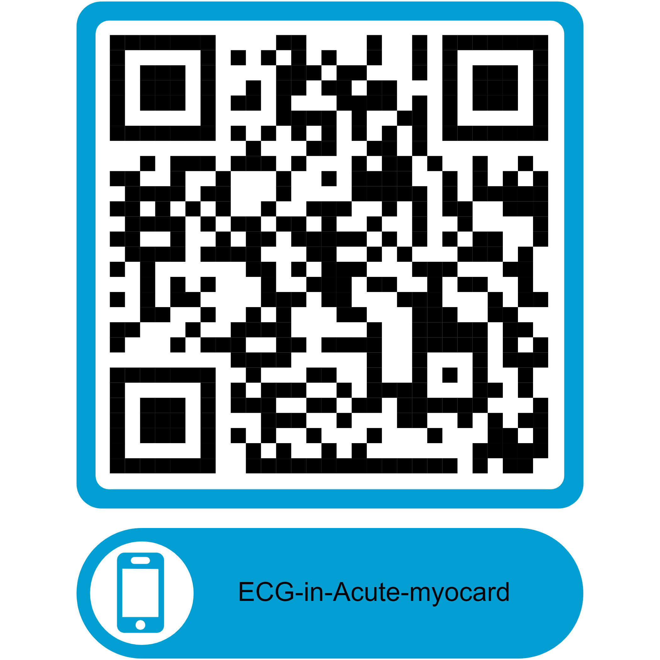 QR Code ECG-in-Acute-myocardial-infarction